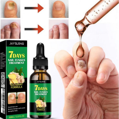 JAYSUING - 7 DAYS TRATAMIENTO PARA HONGOS EN UÑAS – PIES Y MANOS (30 ML)